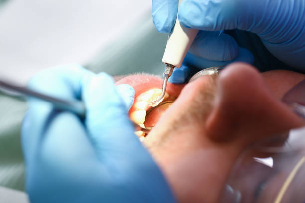 Urgent Tooth Repair in PA